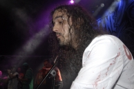 HAEMORRHAGE